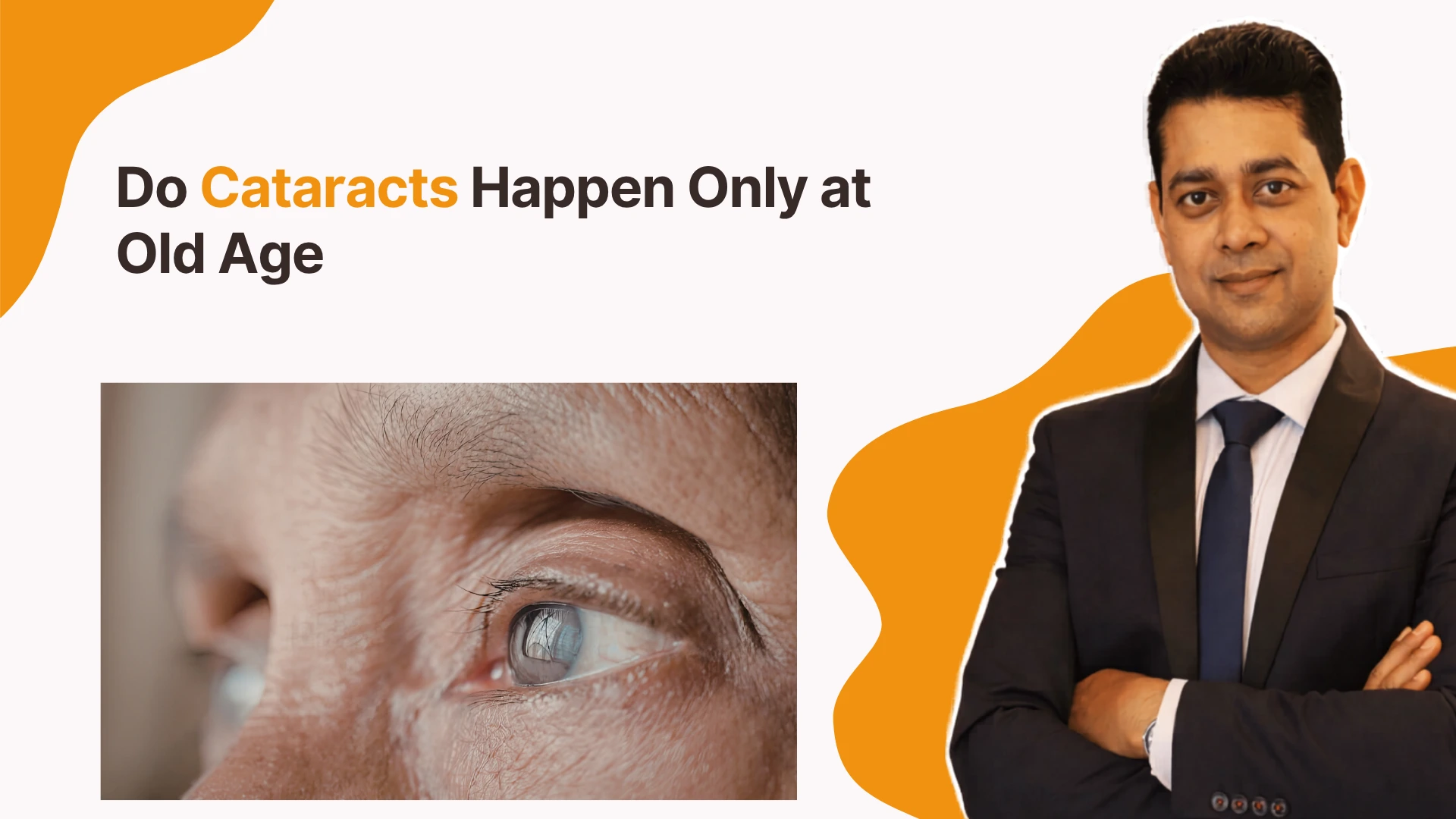 Do Cataracts Happen Only at Old Age | Best General Ophthalmology Doctor in Gunjur