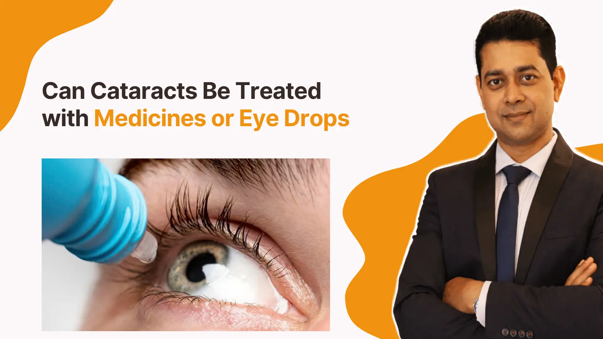 Can Cataracts Be Treated with Medicines or Eye Drops| Cataract Eye Surgery Specialist in Gunjur