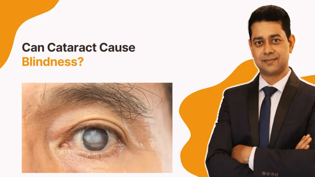 Cataract Treatment Specialist in Gunjur