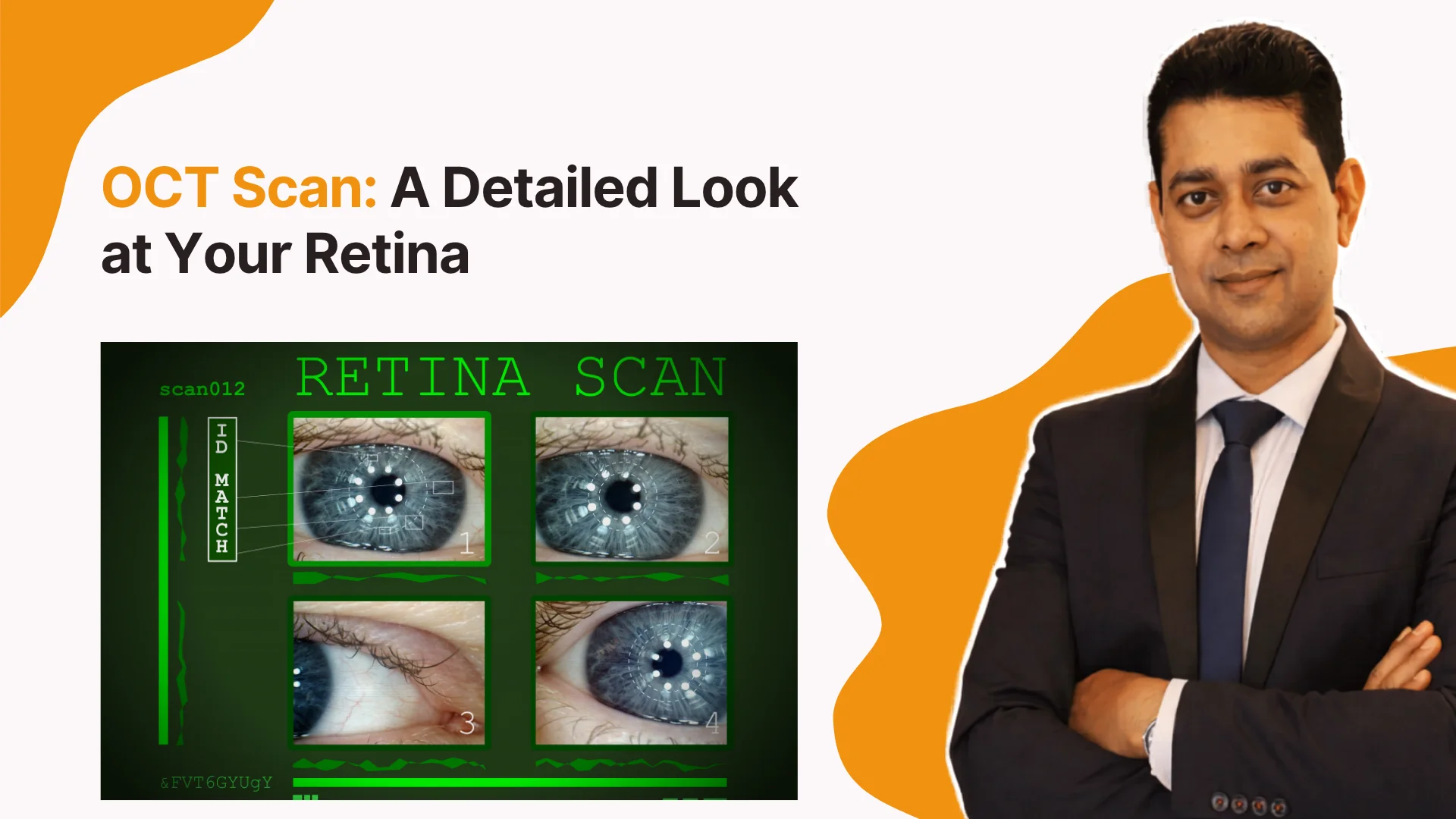 OCT Scan: A Detailed Look at Your Retina | Retina Specialist Doctor in Gunjur